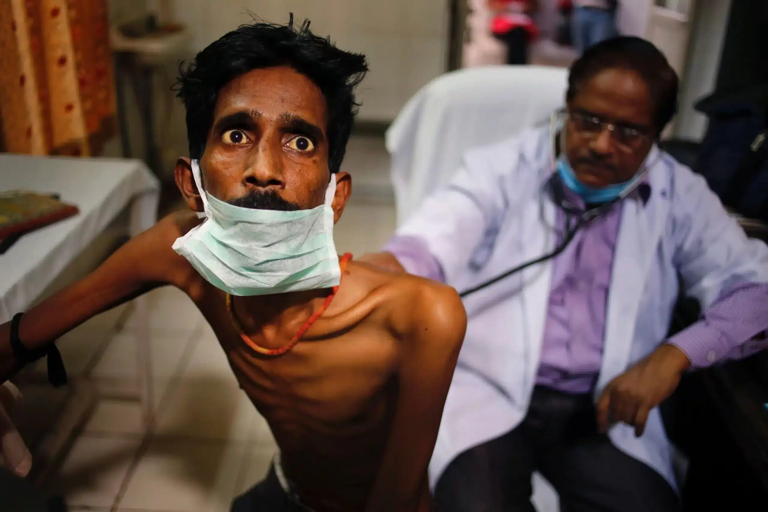 India accounts for 26% of Global TB Reported Cases