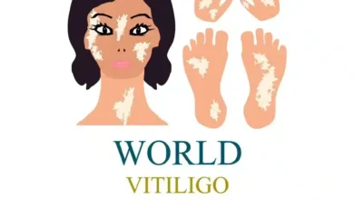 World Vitiligo Day