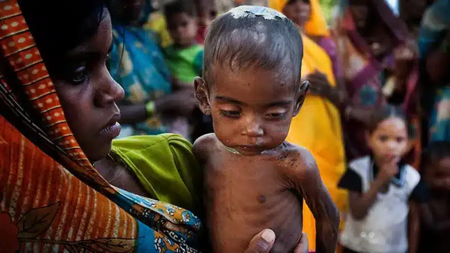 Malnutrition Free India