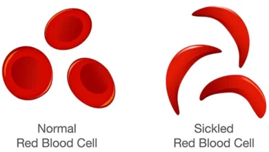 World Sickle Cell Awareness Day 2022