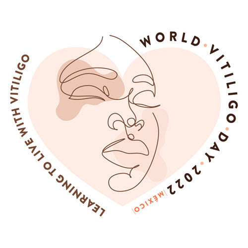 World Vitiligo Day 2022 and its Significance