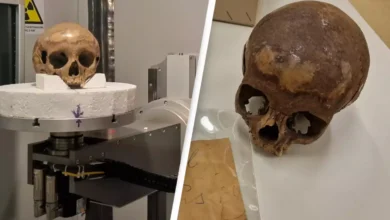 Mystery of the Skull in Turkey Unveiled