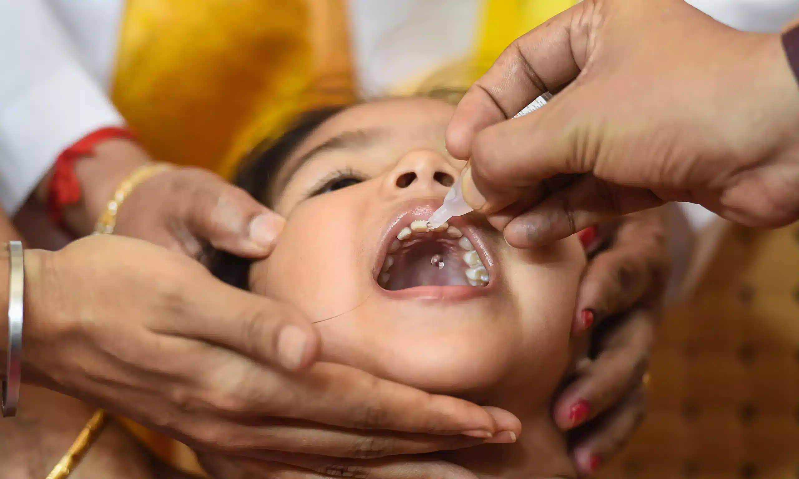 The Ongoing Fight Against Polio in 2025