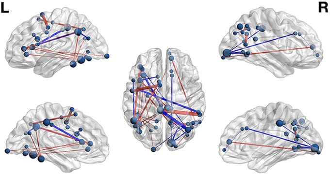New Study Reveals Brain Activity Patterns During Reading