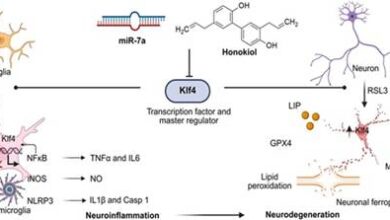 Towards a potential cure for Alzheimer’s Disease