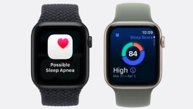 Apple Watch Series 11 vs Series 10: Upgrade Now or Wait?