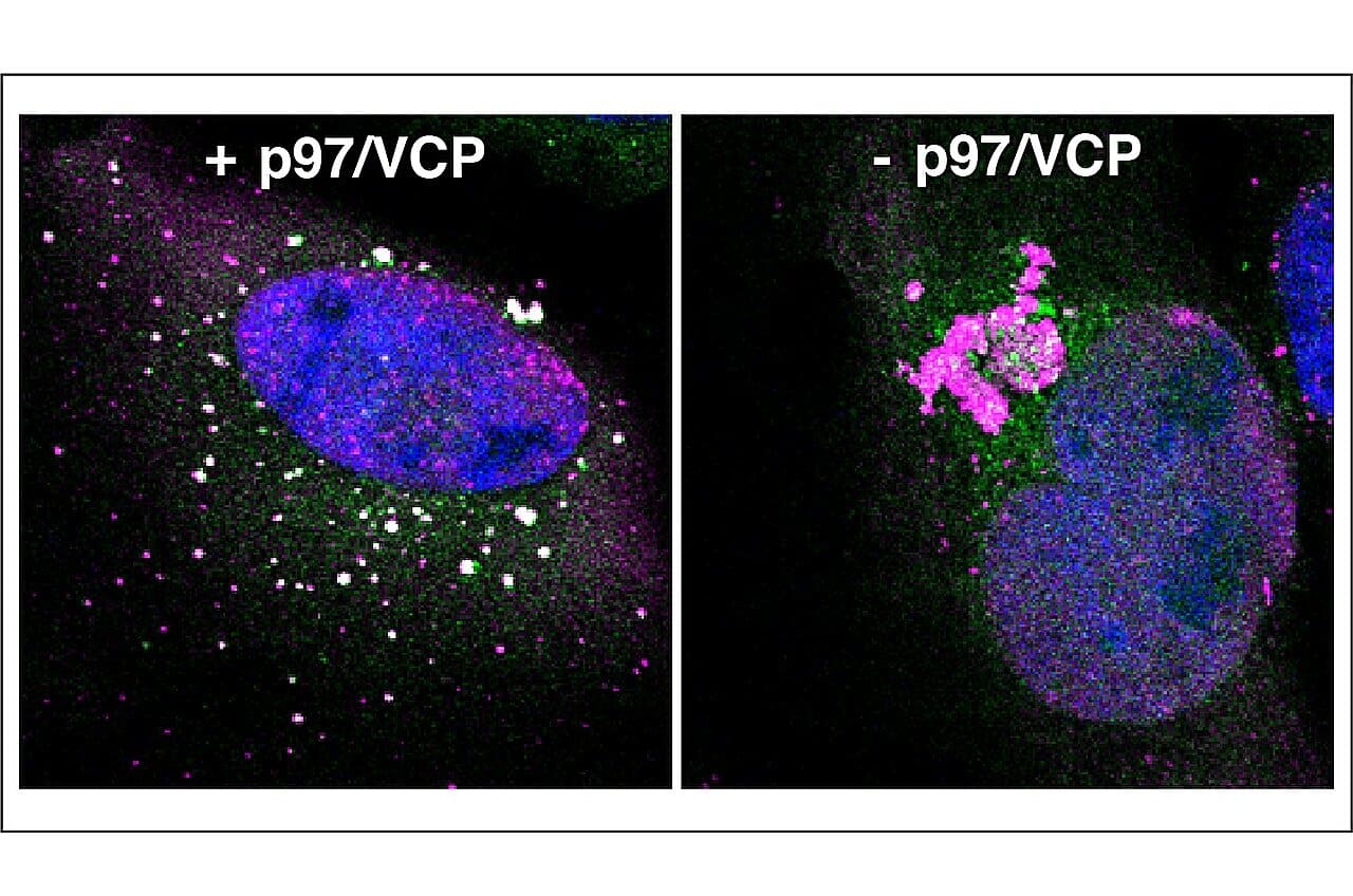 New Research Reveals Key Role of Proteins in Cellular Cleanup Process ...