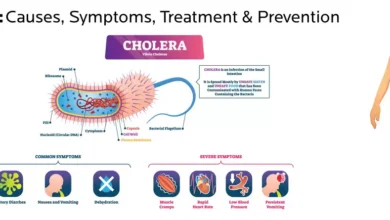 Cholera