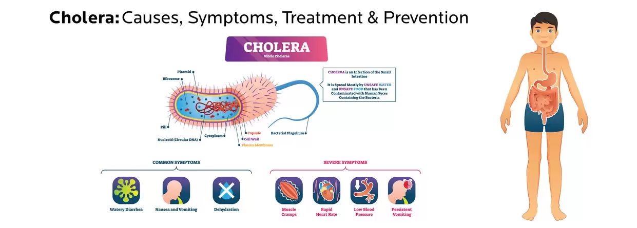 Cholera