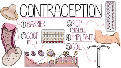 Contraception