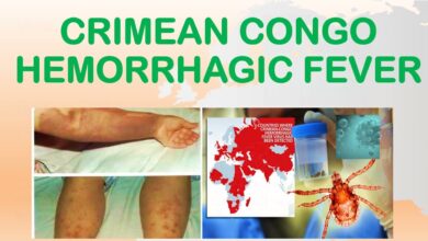 Crimean-Congo hemorrhagic fever