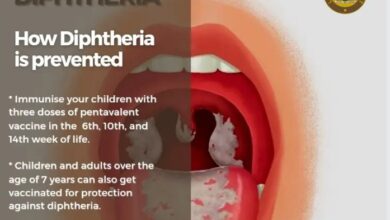 Diphtheria