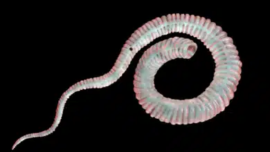 Dracunculiasis (Guinea-worm disease)