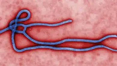Ebola virus disease