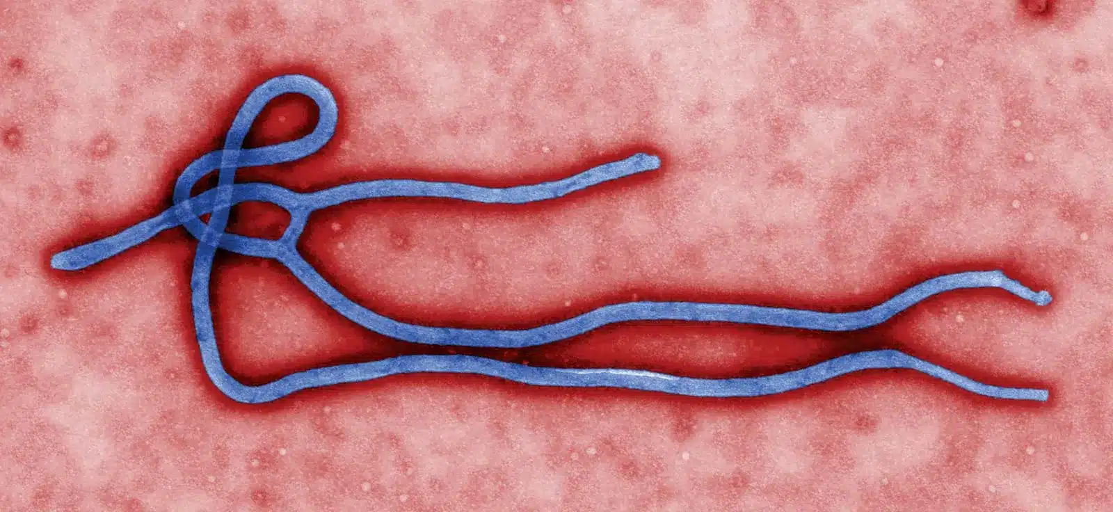 Ebola virus disease
