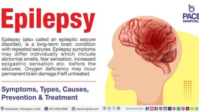 Epilepsy