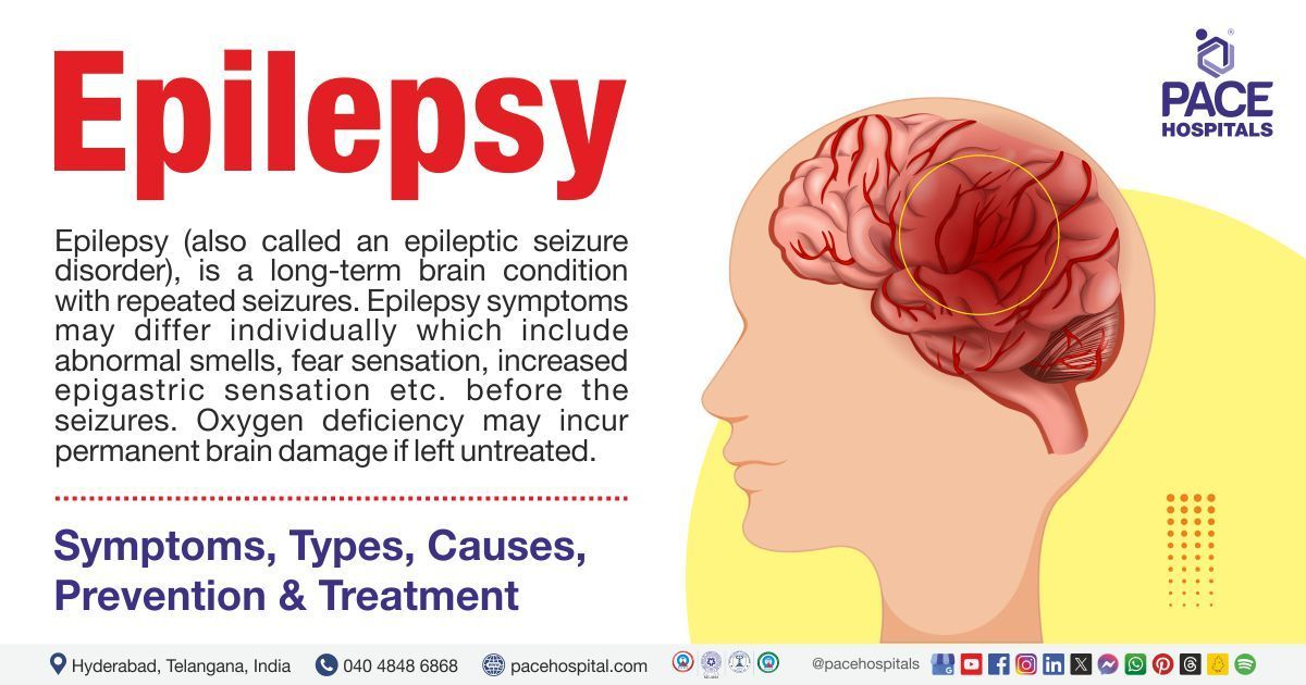 Epilepsy