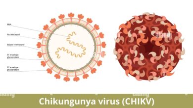 Chikungunya
