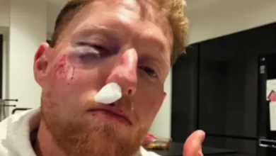 England's Ben Stokes Suffers Severe Facial Injury During Test Match