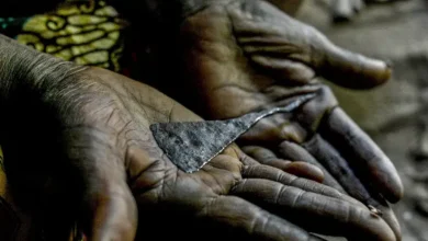 Female genital mutilation