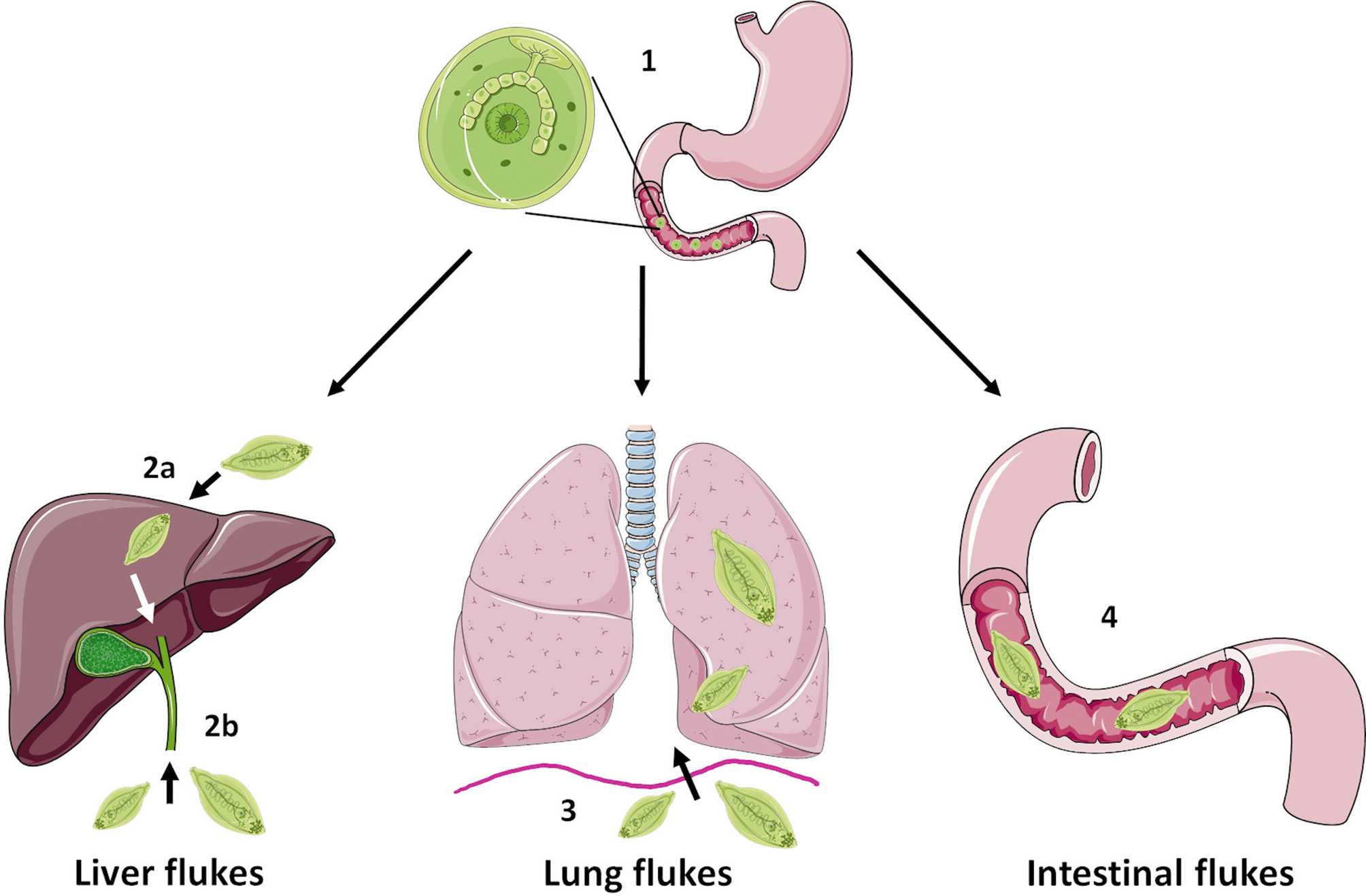 Foodborne trematode infections: Parasitic worms causing liver and lung disease Foodborne trematode infections: Parasitic worms causing liver and lung disease
