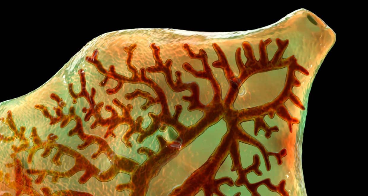 Foodborne trematode infections