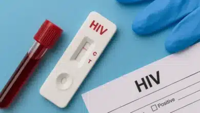 HIV: Infection attacking body's immune system