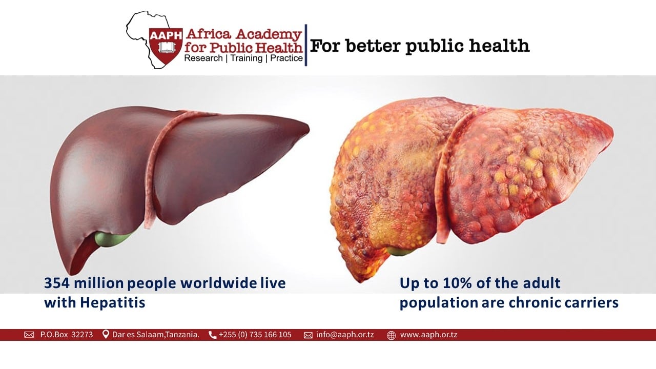 Hepatitis: Liver inflammation causing severe disease and cancer worldwide