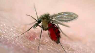 Leishmaniasis