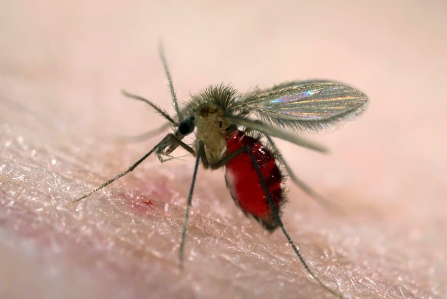 Leishmaniasis