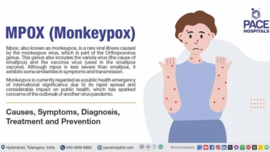 Mpox: Understanding the Viral Disease Formerly Known as Monkeypox