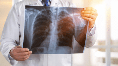 New Guidelines Unveiled for Lung Cancer Treatment in India