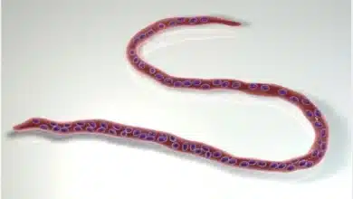 Onchocerciasis: The Parasitic Disease Causing Preventable Blindness