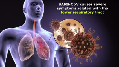 Healthcare worker wearing N95 respirator and protective equipment during SARS outbreak 2003 demonstrating infection control protocols