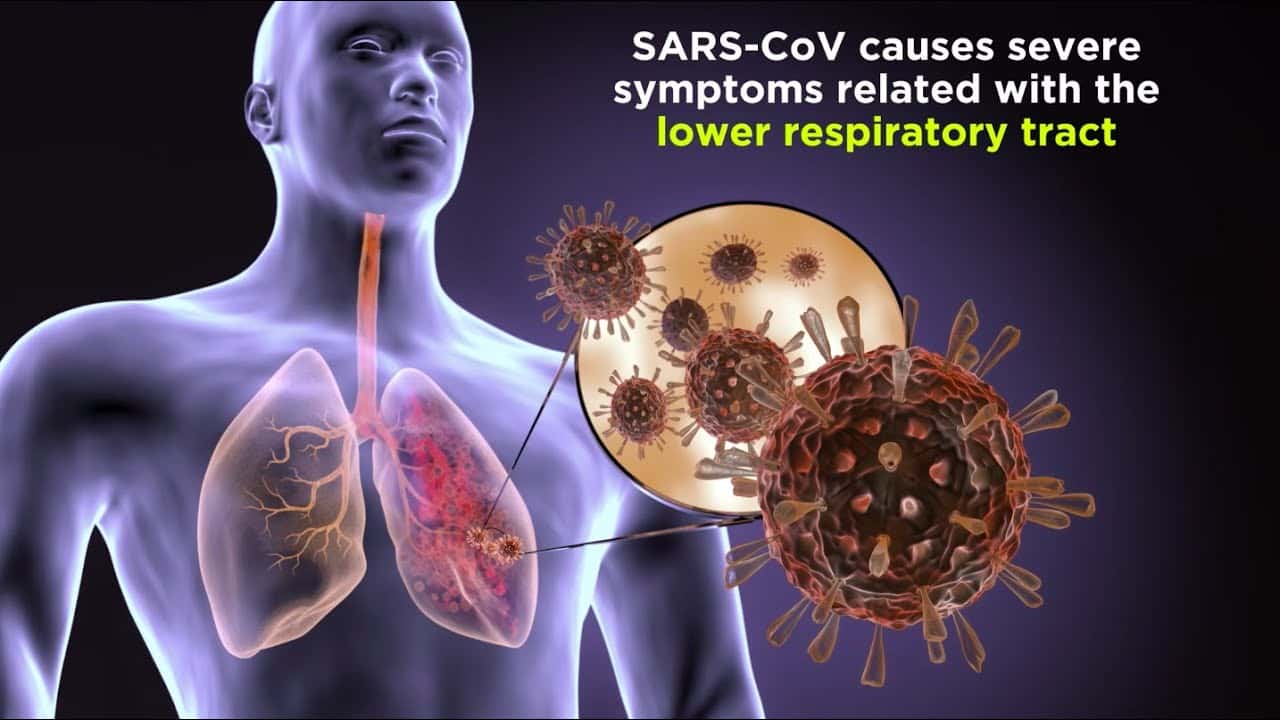 Healthcare worker wearing N95 respirator and protective equipment during SARS outbreak 2003 demonstrating infection control protocols