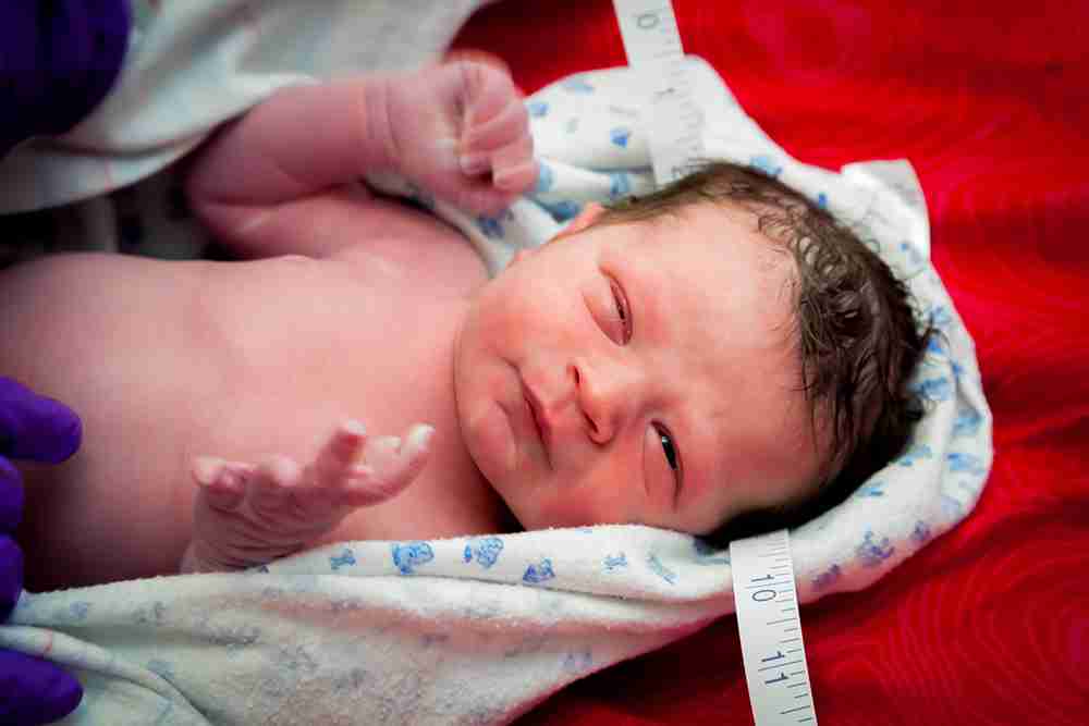 WHO stillbirth prevention data showing global burden in low-income countries with 2 million annual deaths