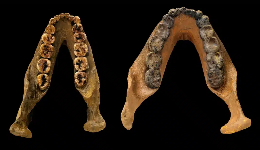 Discoveries from Ancient Teeth: Clues to Human Origins