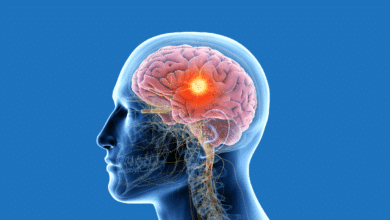 Brain Tumors