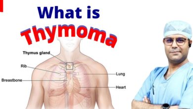 Thymoma and Thymic Carcinoma