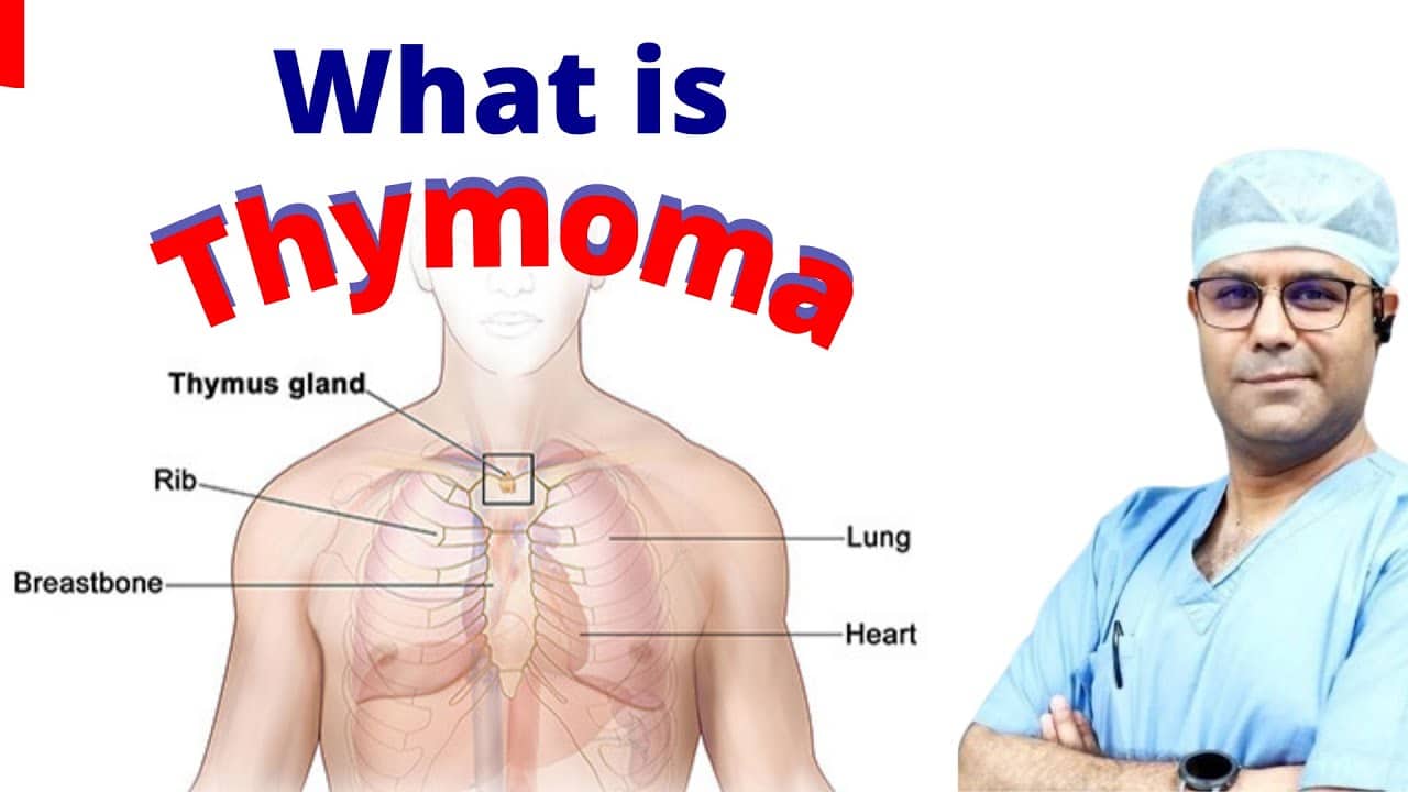 Thymoma and Thymic Carcinoma