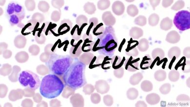 Chronic Myeloid Leukemia (CML)