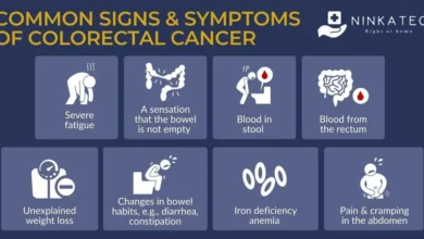 Colon Cancer Symptoms