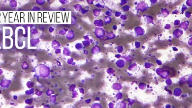 Diffuse Large B-Cell Lymphoma