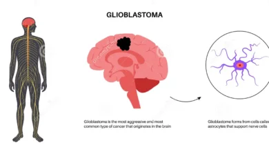 Glioblastoma Multiforme