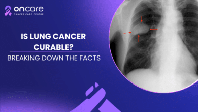 Lung Cancer