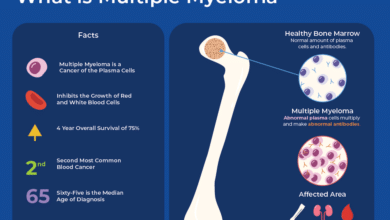 Multiple Myeloma