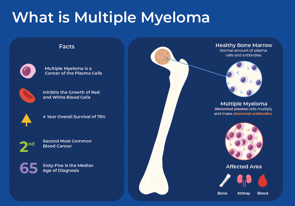 Multiple Myeloma