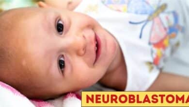 Neuroblastoma