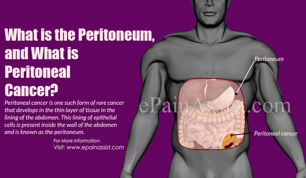 Primary Peritoneal Cancer