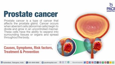 Prostate Cancer